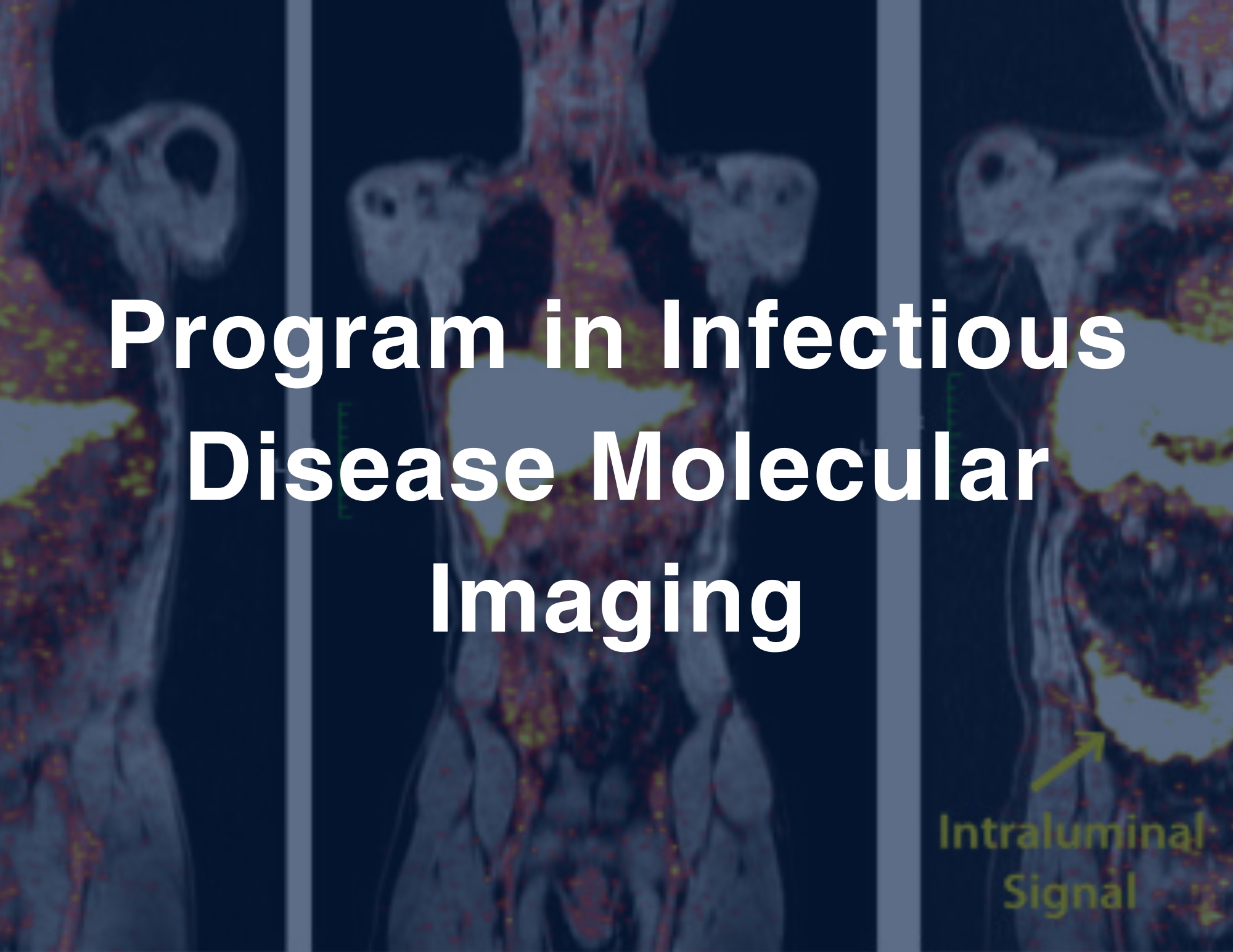 Program in Infectious Disease Molecular Imaging